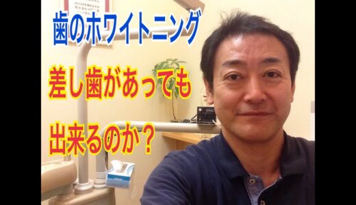 差し歯、詰め物があっても歯のホワイトニングは出来るのか？【御茶ノ水 歯医者】