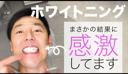 【実証】歯医者さんでのホワイトニングで歯は本当に白くなる？【たった１回で驚きの結果に…】