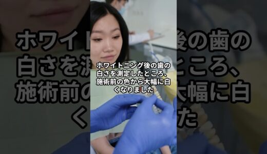 サロンのオフィスホワイトニングの様子全部見せます【東京】圧倒的な変化でたった2回で劇的美白✨