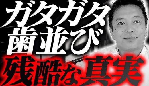 【あなたは大丈夫？】歯並びが悪いことの影響3選【歯医者】