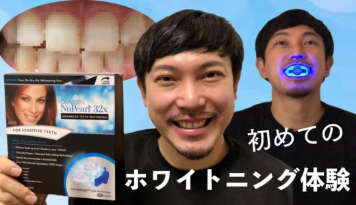 【初めてのホワイトニング】ニューパールさんのホームホワイトニングキットを使って真っ白な歯を目指す！約一週間でどれだけ白くなれるかチャレンジ！