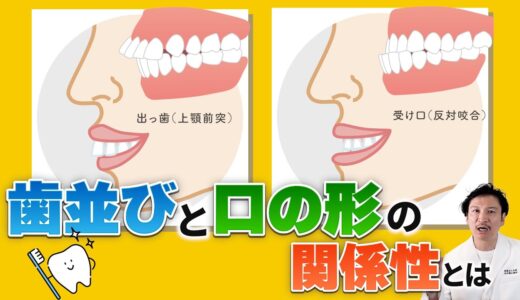 歯並びとお口の形は関係する！様々な歯並びとそれに伴うお口の形の変化を説明します！