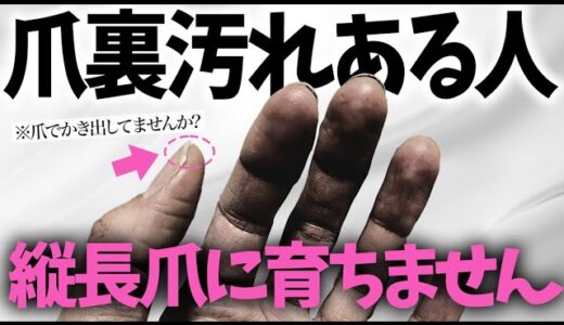 【爪裏汚れ対策】実は育爪の大敵だった！美爪を保つための爪裏汚れ対策決定版