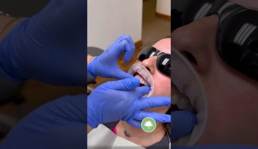 Attachment Process | Dr. Bangs | Pecan Park Dental