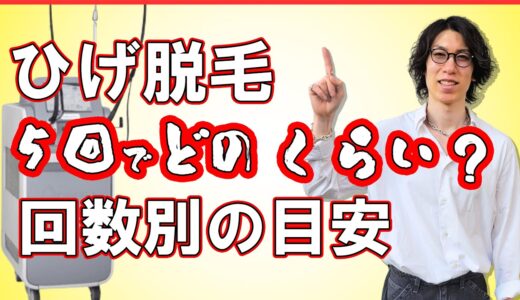 【男性医療脱毛】髭脱毛の回数別の効果の体感についておおよその目安を経験者が解説！
