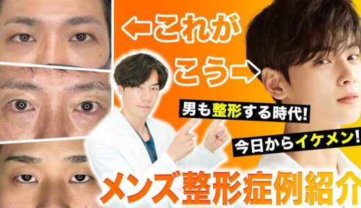 【メンズ整形】整形は女性だけじゃない！ 男性の症例写真を大公開！