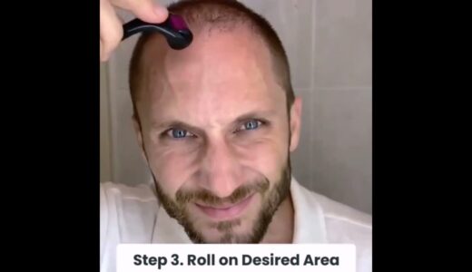 Derma Roller Microneedle Roller | Face, Beard, and Scalp Care Kit