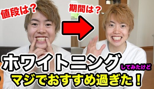 ホワイトニングがマジで良かった！値段とかどんな感じか紹介していくー！