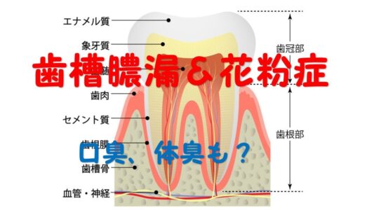 歯槽膿漏＆花粉症　口臭　体臭　2024 08 8