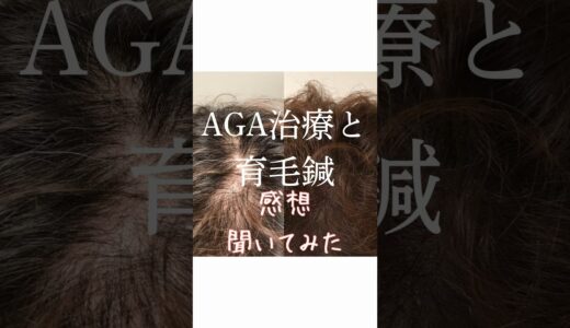 AGA治療と育毛鍼　感想聞いてみた　#のむち鍼