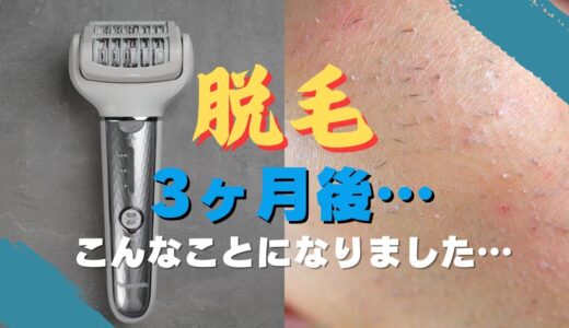 ちくしょう！埋没毛だらけ！脱毛をしようとしている方へ…パナソニック　soieを3ヶ月使ってみたら