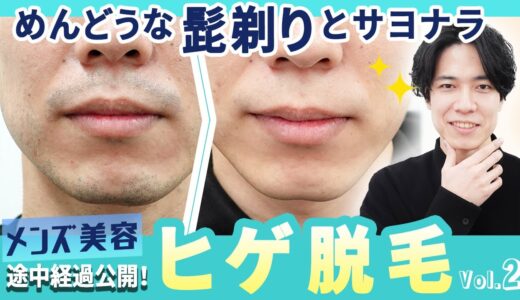 【施術モニター体験レポ！】②ヒゲ脱毛の施術と経過をお見せします メンズ医療脱毛