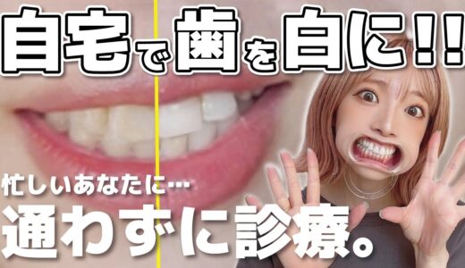 自宅で出来るホワイトニング…実際どうなの？自然に白くなっていく過程を動画で見せます！歯科医師とオンライン診療で歯医者に通う必要がない！