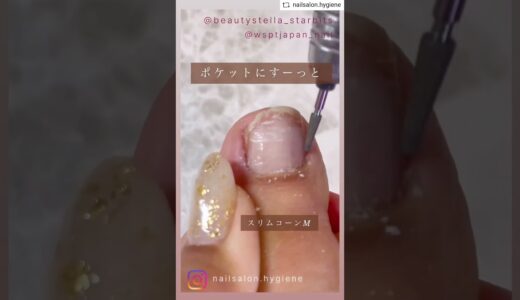 フットの指周りのケア