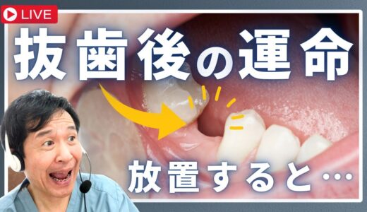 【歯が抜けて放置した場合のメリット＆デメリット】歯医者がわかりやすく解説します‼︎