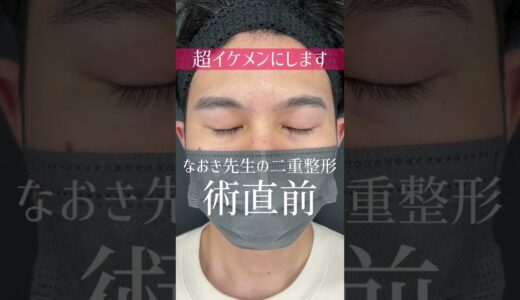 【イケメン爆誕】なおき先生のメンズ二重整形‼︎【保存版】