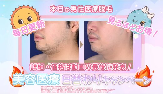 男性の医療脱毛（もみあげ周囲・頬）1回が情熱プライスキャンペーン‼️【湘南美容で3日間限定特別プライス】【2024/10/09~10/11　19:00まで受付中】