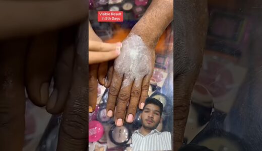 Full body whitening cream amazing result #explorepage #shortfeed #shorts #viralvideo #trendingshorts