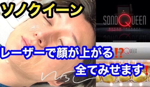 【ソノクイーン】レーザーで顔が上がる！？全て見せます！！