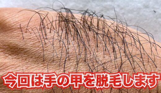 趣味脱毛241117手の甲　Hair Removal