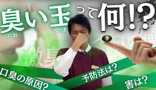 【必見】臭い玉ってなに！？現役口臭外来が徹底解説！