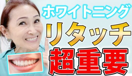 【超重要】白い歯を持続させるにはホワイトニングのリタッチは必ずやってください！