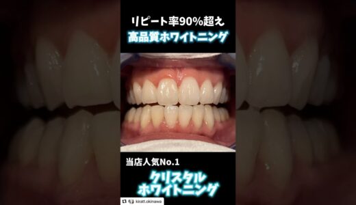 これが初回の効果🦷✨️年末までにまだ間に合います！！ぜひKirattのホワイトニングお試しください☺️#Kiratt #沖縄ホワイトニング#ビフォーアフター#白い歯#清潔感アップ