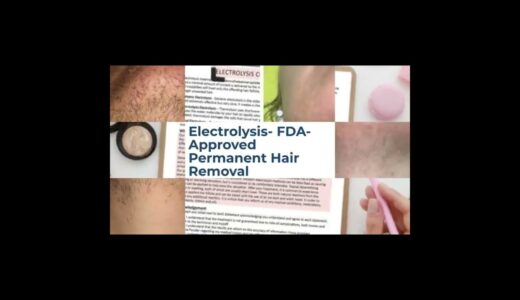 Caltrology Electrolysis Permanent Hair Removal Experts in Solana Beach, CA