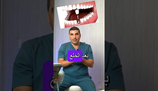 تأخير زراعة الأسنان بعد الخلع = مشاكل لا تنتهي ! شاهد ماذا سيحدث لفكك! #dentist#زراعة_الأسنان