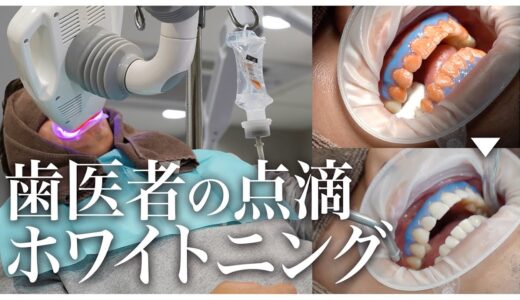 ホワイトニングで清潔感アップ！併用で施術可能な点滴もご紹介【名古屋あおい歯科・矯正歯科】