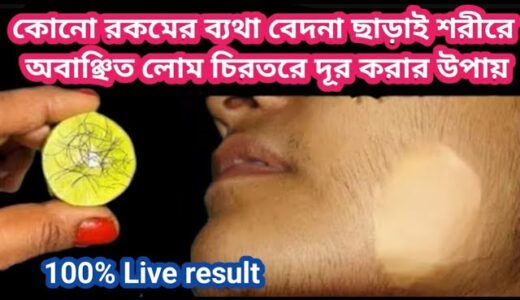 ১ মিনিটে চিরতরে মুখের অবাঞ্ছিত লোম দূর করার ঘরোয়া উপায়//face hair removal for women at home